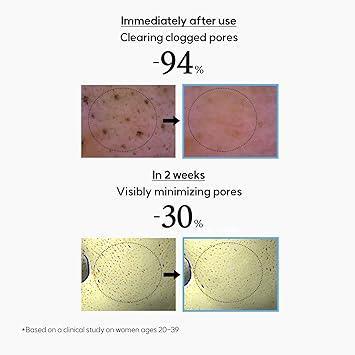 [Hanyul] Chestnut Shell Pore Clearing Clay Mask 100ml